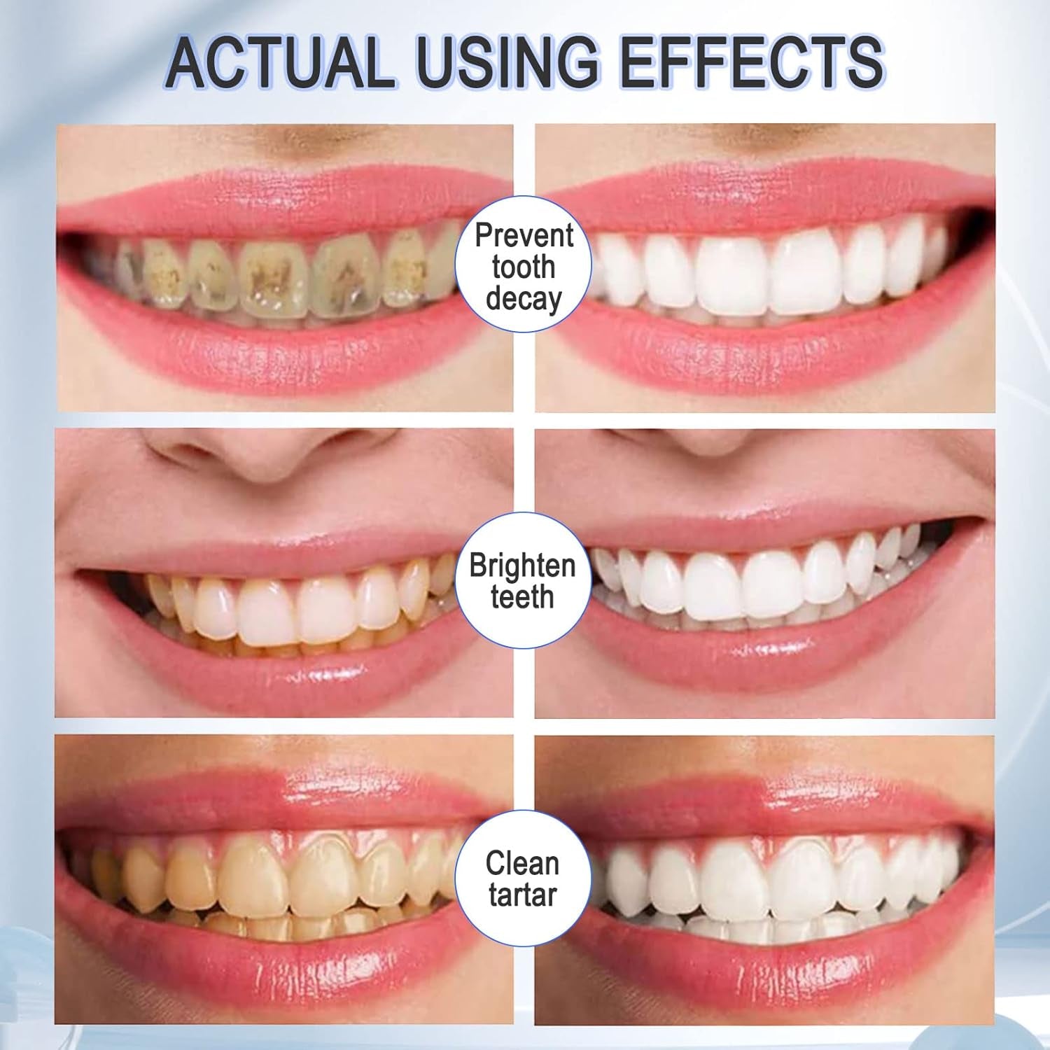 Teeth Whitening Toothpaste with Fluoride, Ultra-Fine Mousse Foam for Deep Cleaning Gums, Stain Removal, 3 Fresh Flavors